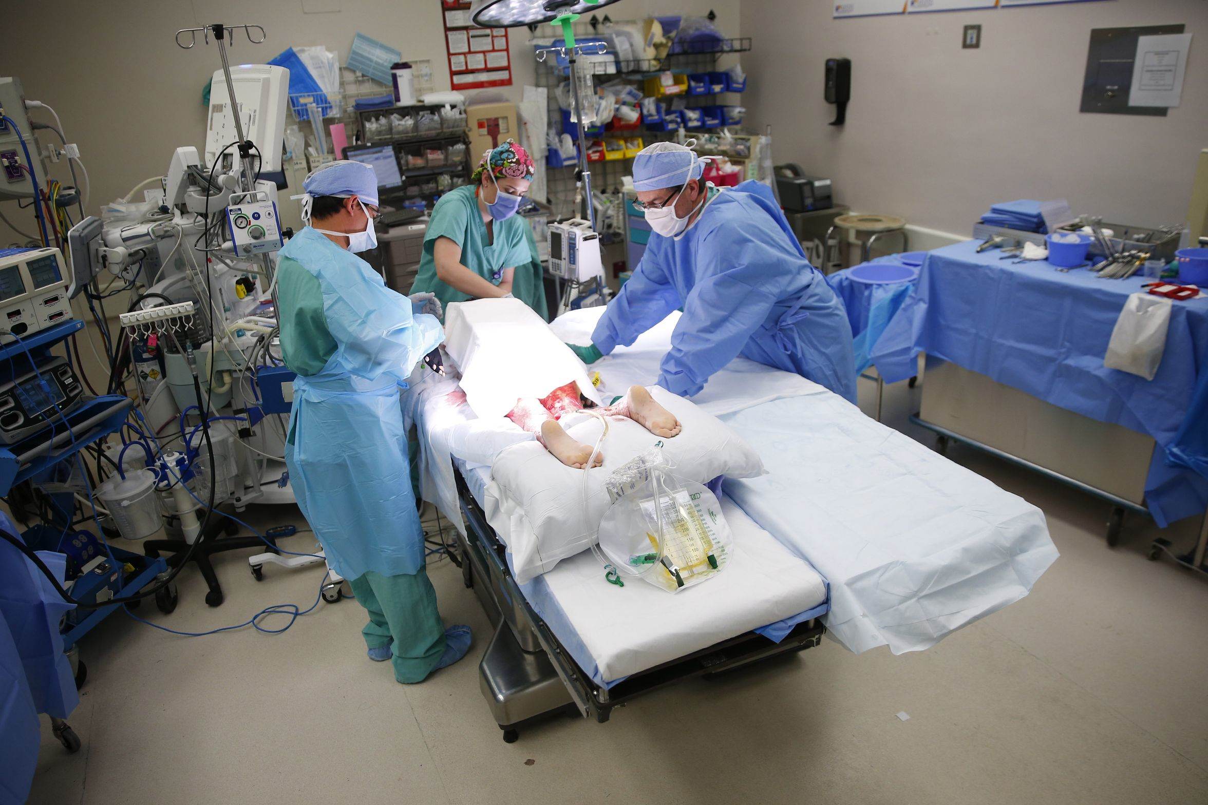 Dr. Kevin Foster (right) stands over Isabella McCune during surgery at the Arizona Burn Center in Phoenix May 24, 2018. She was severely burned in a home accident in March.